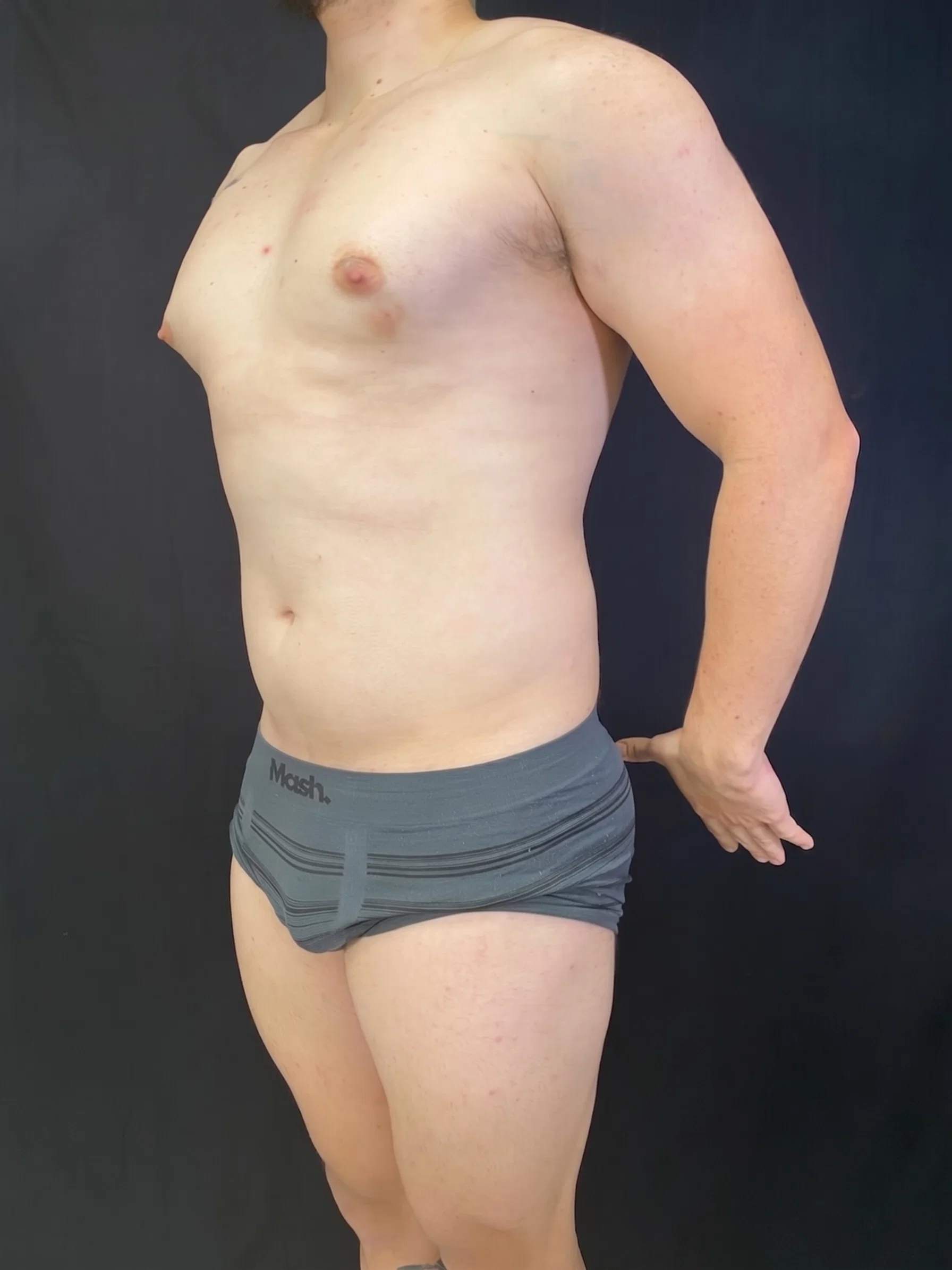 Transferencia Masculina